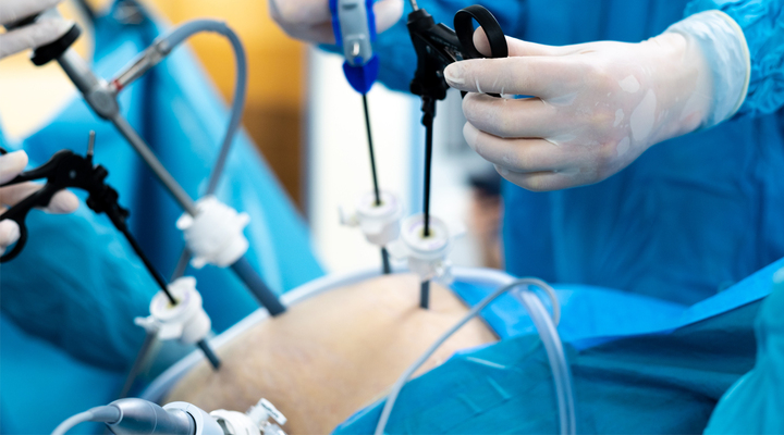 How Can I Choose the Best Bariatric Surgeon in My City?