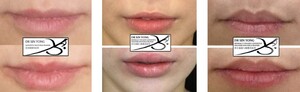 Understanding the Meaning of Luscious Lips