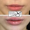 Understanding the Meaning of Luscious Lips