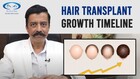 Decoding the Cost of Hair Transplants